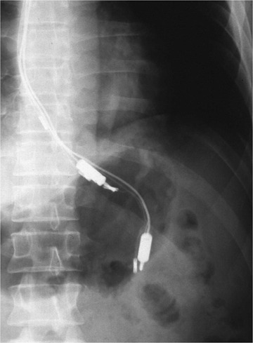  an abdominal x-ray